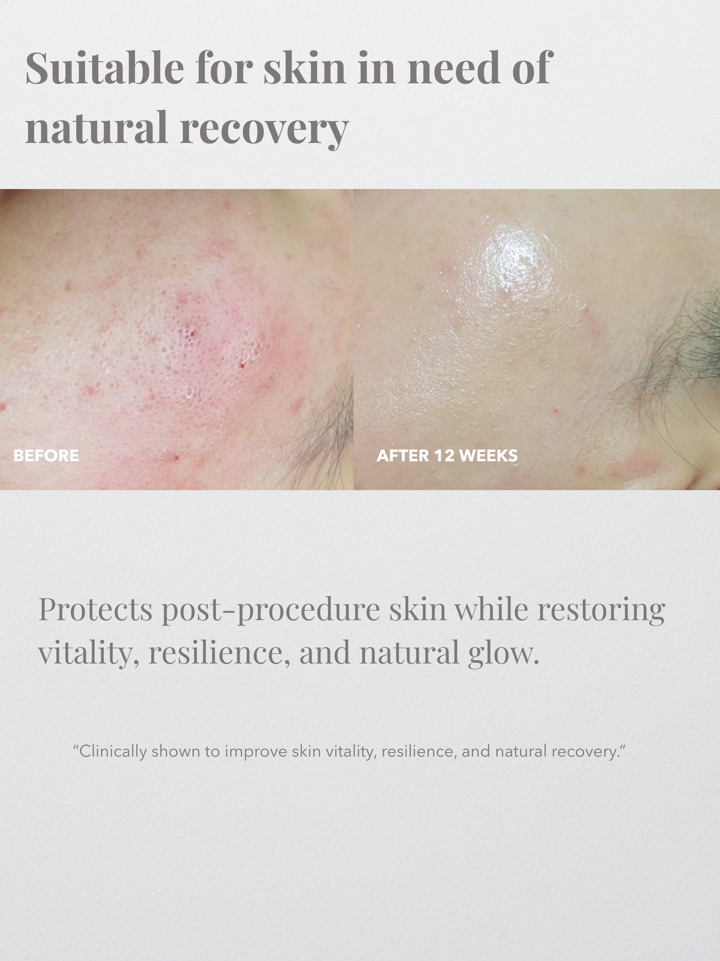 Sizopirin Cellular Mess Cream 35mL